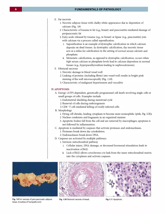 Fundamentals of Pathology: Medical Course and Step 1 Review: 2019 Edition