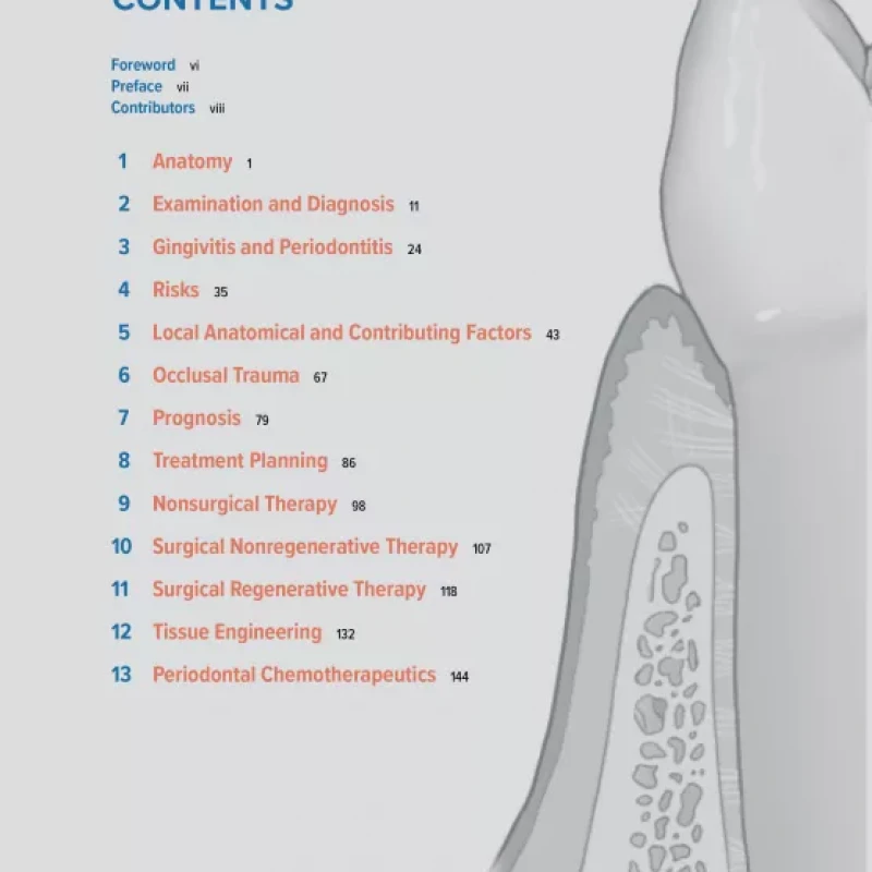 Periodontics The Complete Summary