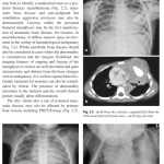 Sách Imaging in Pediatric Oncology