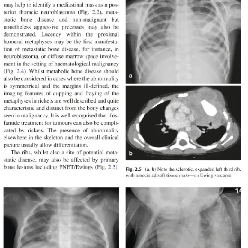Sách Imaging in Pediatric Oncology