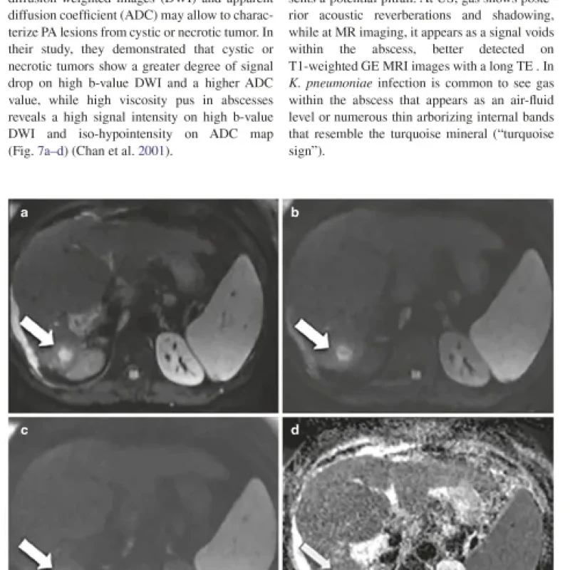 Sách Imaging of the Liver and Intra-hepatic Biliary Tract Volume 2