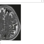 Sách Oncologic Imaging Bone Tumors