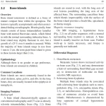 Sách Oncologic Imaging Bone Tumors